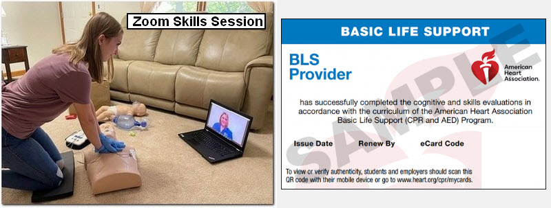 AHA BLS Skills Check